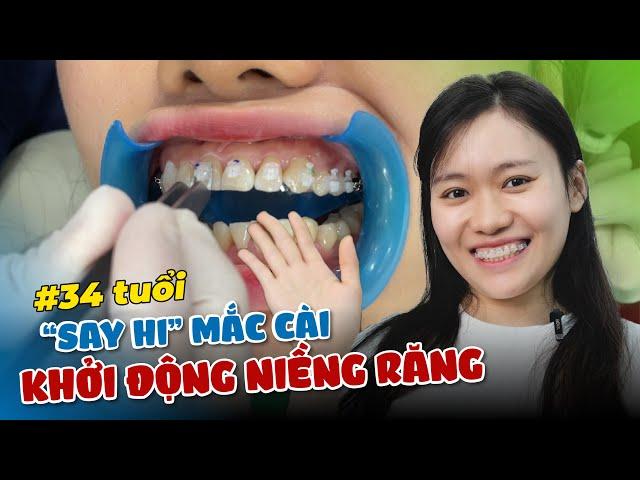 NIỀNG RĂNG KHÔNG NGẠI ĐỘ TUỔI - GẮN MẮC CÀI Ở TUỔI 34