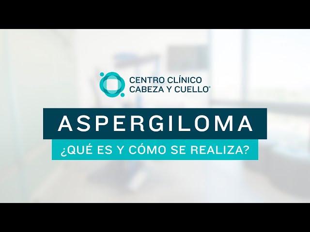 Aspergiloma ¿Qué es y cómo se realiza?