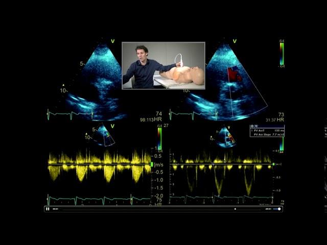 How to perform a full, comprehensive transthoracic echo study