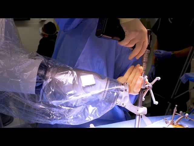 Robotic Spine Surgery Explained