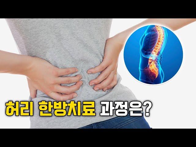 [바디올 한의원] 수술받지 않고 허리가 좋아질 수 있나요? │허리 한방 치료