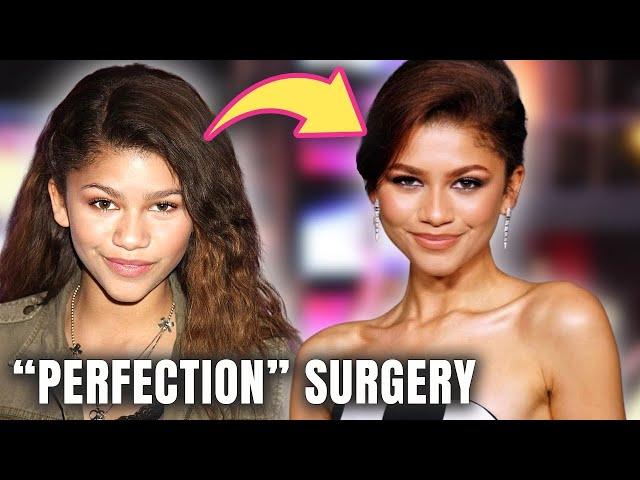 Euphoria’s Zendaya: Plastic Surgery ALMOST Natural