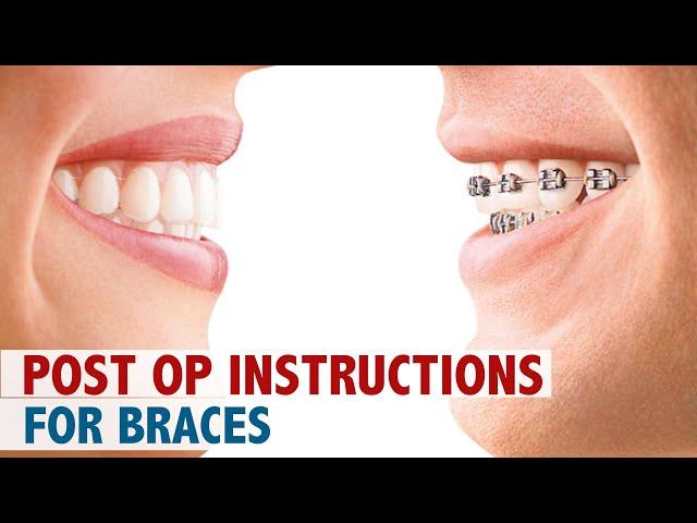 Post Op Instructions For Braces