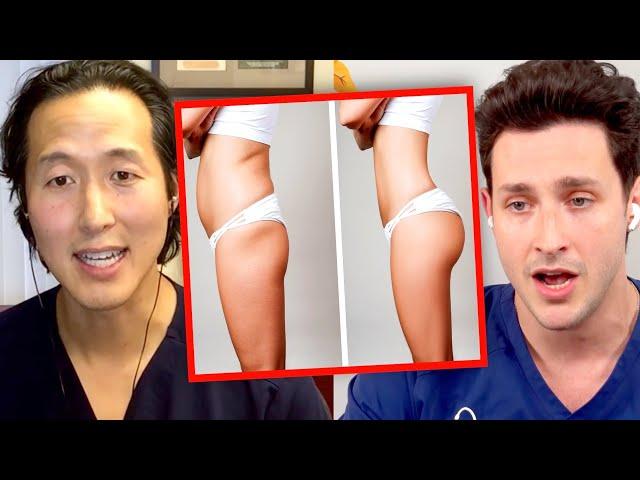 The Deadly Truth Behind Brazilian Butt Lift Surgery (BBL)