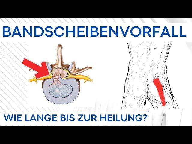 Bandscheibenvorfall - Wie lange bis zur Nervenheilung?