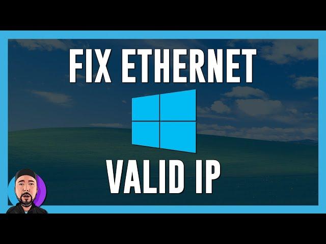 FIX Ethernet doesn't have a valid IP Configuration