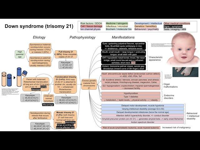 Down syndrome, trisomy 21 (mechanism of disease)