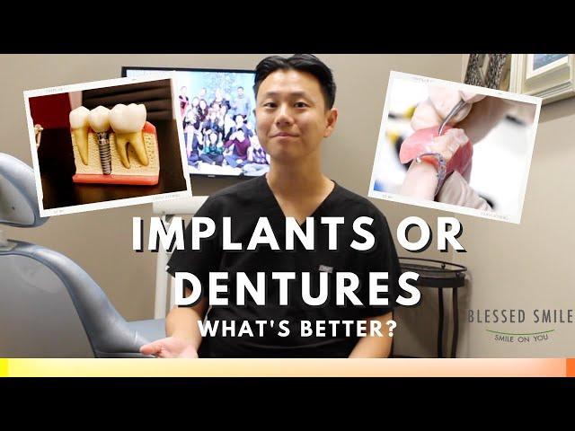 DENTAL IMPLANT vs. DENTURE to Replace Missing Teeth | Dentist Reviews