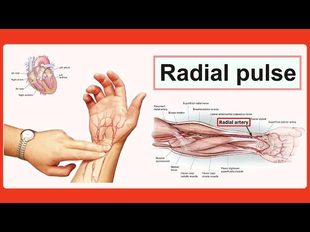 radial pulse