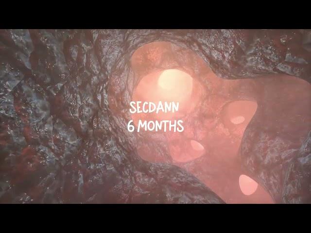 SecDann - 6 Months (Prod. Autrioly)