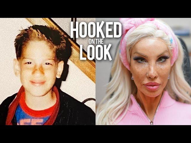 From Teen Boy To $1M Plastic Barbie | HOOKED ON THE LOOK