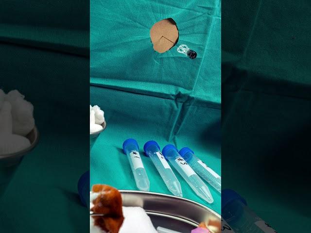 Epic Surgery Milestone: Dr. Morton's Ether Anesthesia Triumph || History #history