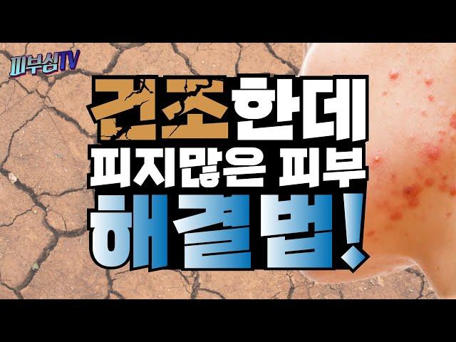 피부는 건조한데 피지가 많은 피부 타입 해결법! [피부과전문의 피부심]