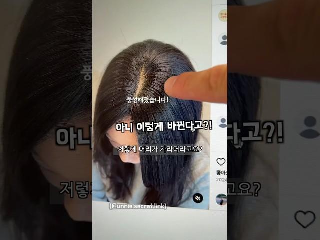탈모가 치료될까 #탈모 #치료제 #제발