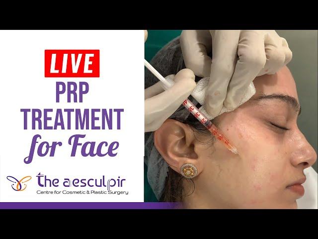 PRP Treatment For Face - How Is It Done? | The Aesculpir | Best Cosmetic Treatments in Delhi