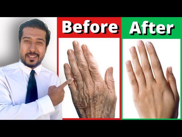 2 Fast Remedies for Dry and Wrinkled Hands THAT WORK