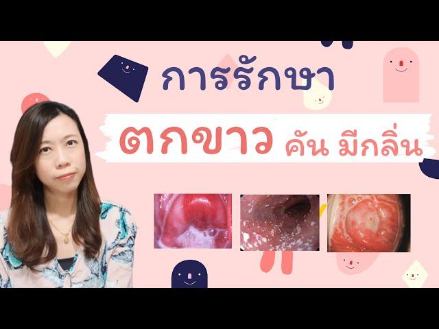 รู้ลึกเรื่องตกขาว อาการ การรักษา ครบจบในคลิปเดียว | หมอยาพาคุย