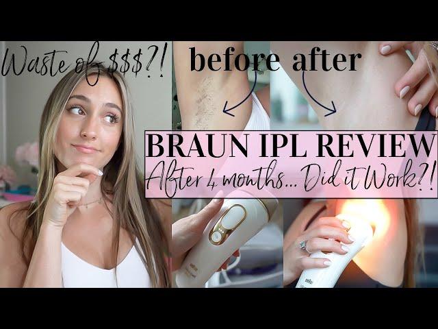 BRAUN IPL REVIEW//DID IT WORK?!//4 months later...//Hair Removal Review & Tutorial