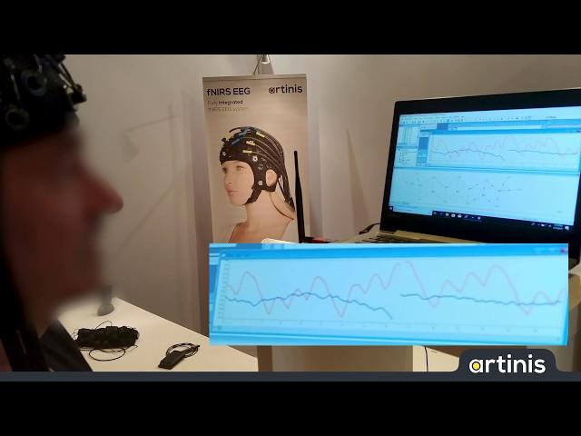 Proofing the Brite fNIRS data quality at the Organization for Human Brain Mapping (OHBM) 2019