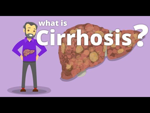 Cirrhosis - What is cirrhosis?