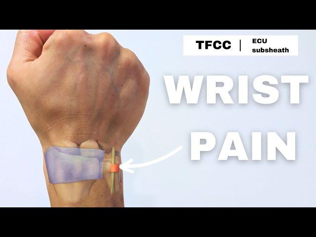 Wrist pain | TFCC | ECU sub-sheath rehab