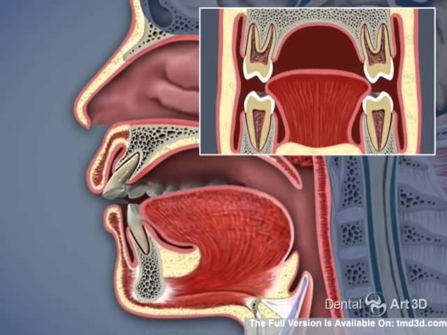 Airway and TMJ