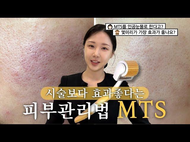 요즘 핫한 셀프MTS, 부작용은 없는데 효과 배로 보는법