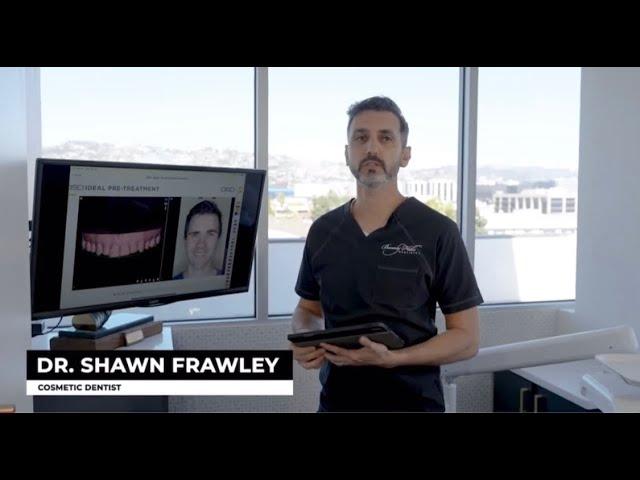 The Smile Makeover Process | Beverly Hills Dentistry | Dr. Shawn Frawley