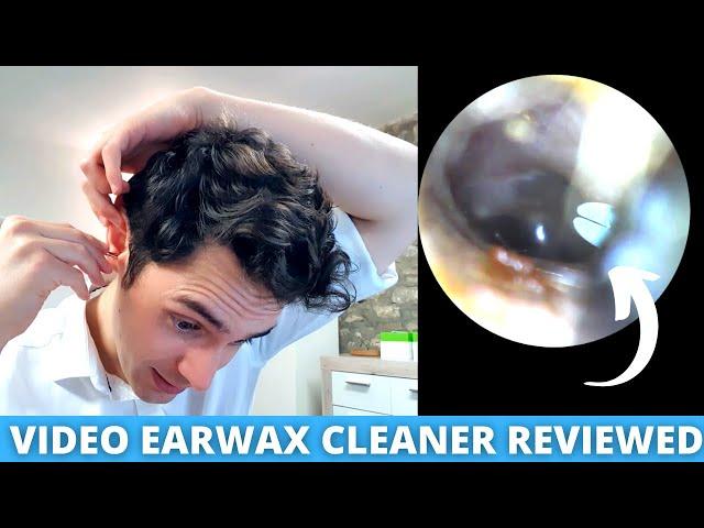 Ear Specialist Reviews Home Ear Wax Removal Camera (Bebird Earokay Ear Cleaner)