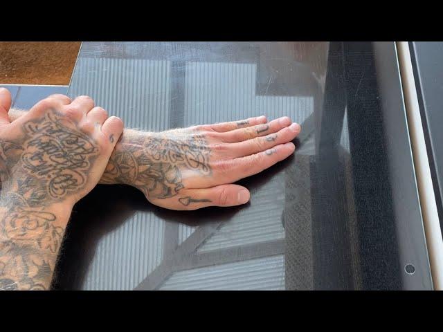 Scaphoid Fracture: My full recovery routine (physio & exercises)