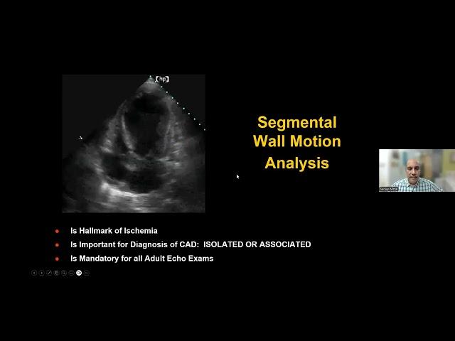 2024 08 02 20 16 38 Talk on LV systolic function by Dr Sanjay Mittal