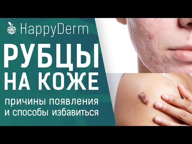 РУБЦЫ НА КОЖЕ, ПОЧЕМУ ПОЯВЛЯЮТСЯ? ПРОФИЛАКТИКА ПОЯВЛЕНИЯ КЕЛОИДНЫХ РУБЦОВ И КАК ИЗБАВИТЬСЯ ОТ ШРАМОВ