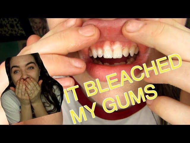 WHITENING MY TEETH GONE WRONG