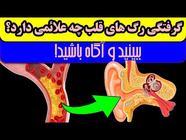 گرفتگی رگـــ ها چه علائم و نشانه هایی دارد؟