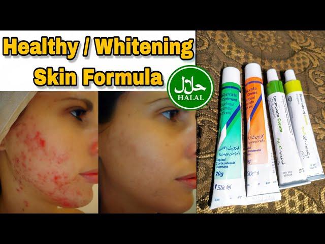Clobevate , Dermovate , Betnovate Cream Formula | Acne Spots Free Skin Formula | Face Whiting Cream