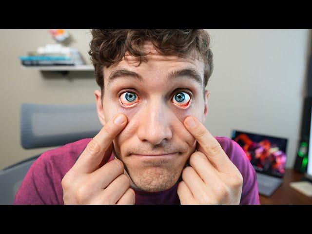 Living with Dry Eyes (what has helped me)