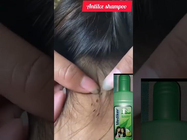 mediker anti lice shampoo