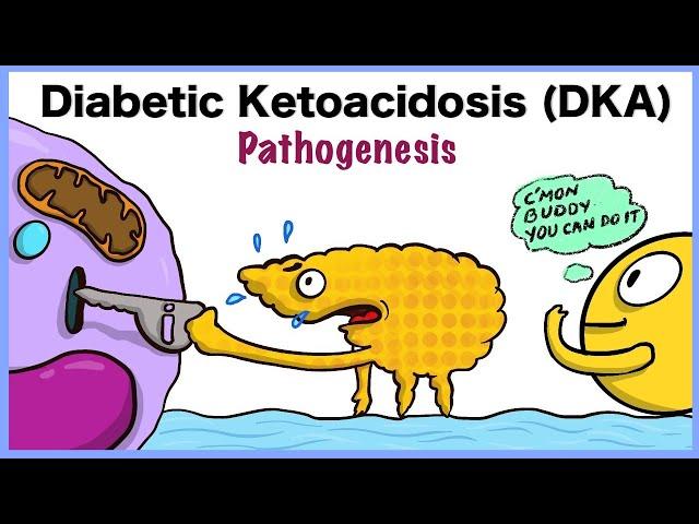 Diabetic Ketoacidosis (DKA) Pathogenesis