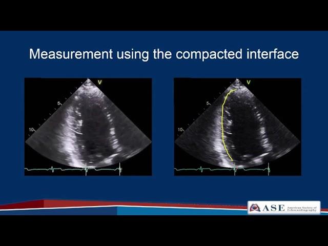 ASE Guidelines for Performing a Comprehensive Echo  in Adults Part 2