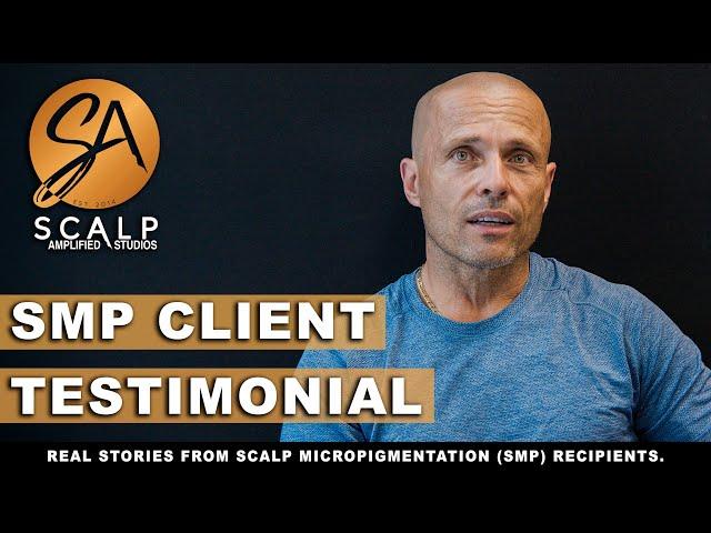 Scalp Micropigmentation Experience at Scalp Amplified Studios, Oakville, ON - Silvio's review