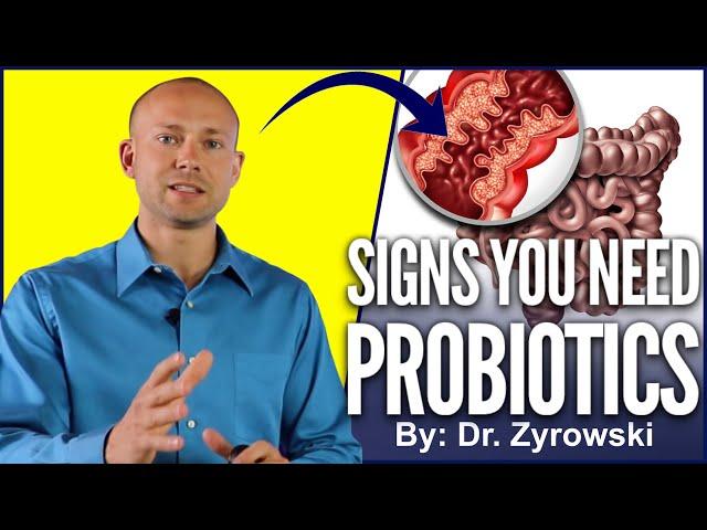 Probiotic Benefits | Top Signs You Should Be Taking A Probiotics