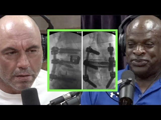 Ronnie Coleman Details His 13 Post Bodybuilding Sugeries | Joe Rogan