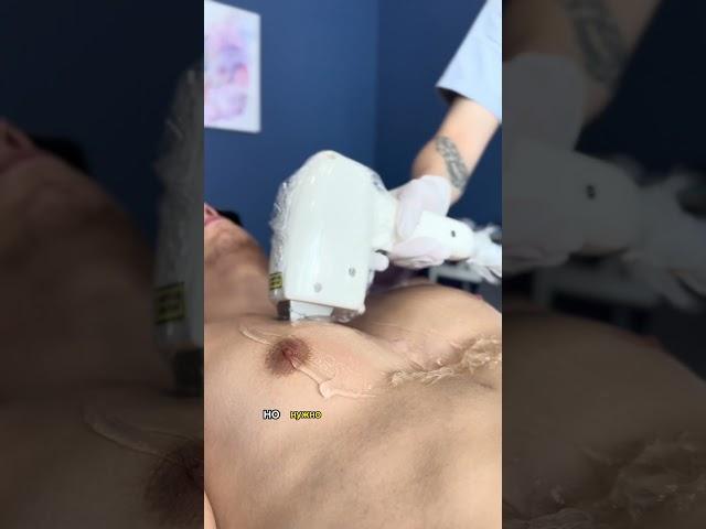 Да, мужчины тоже делают лазерную эпиляцию!