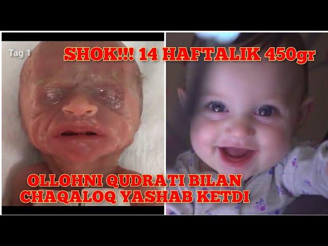 OLLOHNI QUDRATI BILAN 14 HAFTALIK 450gr TUG‘ILGAN QIZALOQ YASHAB KETDI...MASHALLAX!!! 14 week born..