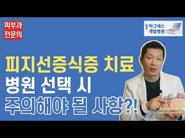 피지선증식증 치료 피부과 선택시 주의사항은?