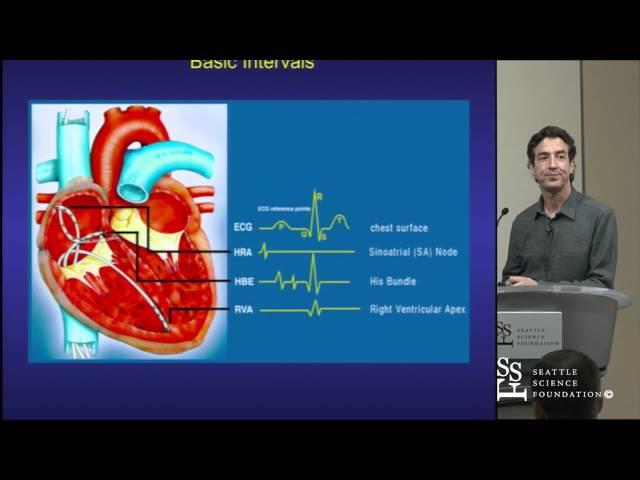 Basics of EP Testing and Ablation by Adam Zivin, M.D.