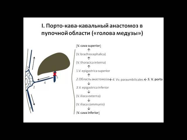 Порто-кавальные анастомозы