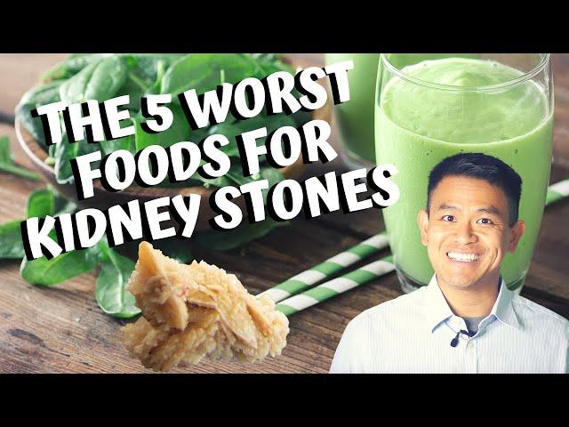 The 5 Worst Foods for Calcium Oxalate Kidney Stones | How to Prevent Getting Kidney Stones (2020)