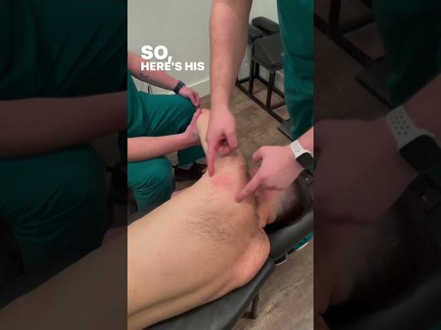 Removing a Junction Adhesion in the #rotatorcuff to Fix Chronic Shoulder Pain