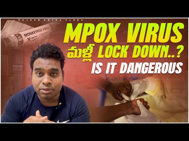 MPox Virus.. మళ్లీ Lock Down..? Is it Dangerous || Rajesh China Vlogs